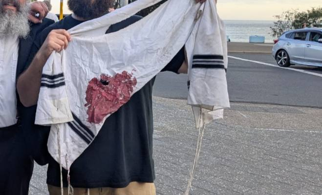 tzitzis at Australia shooting, 12.14.25
